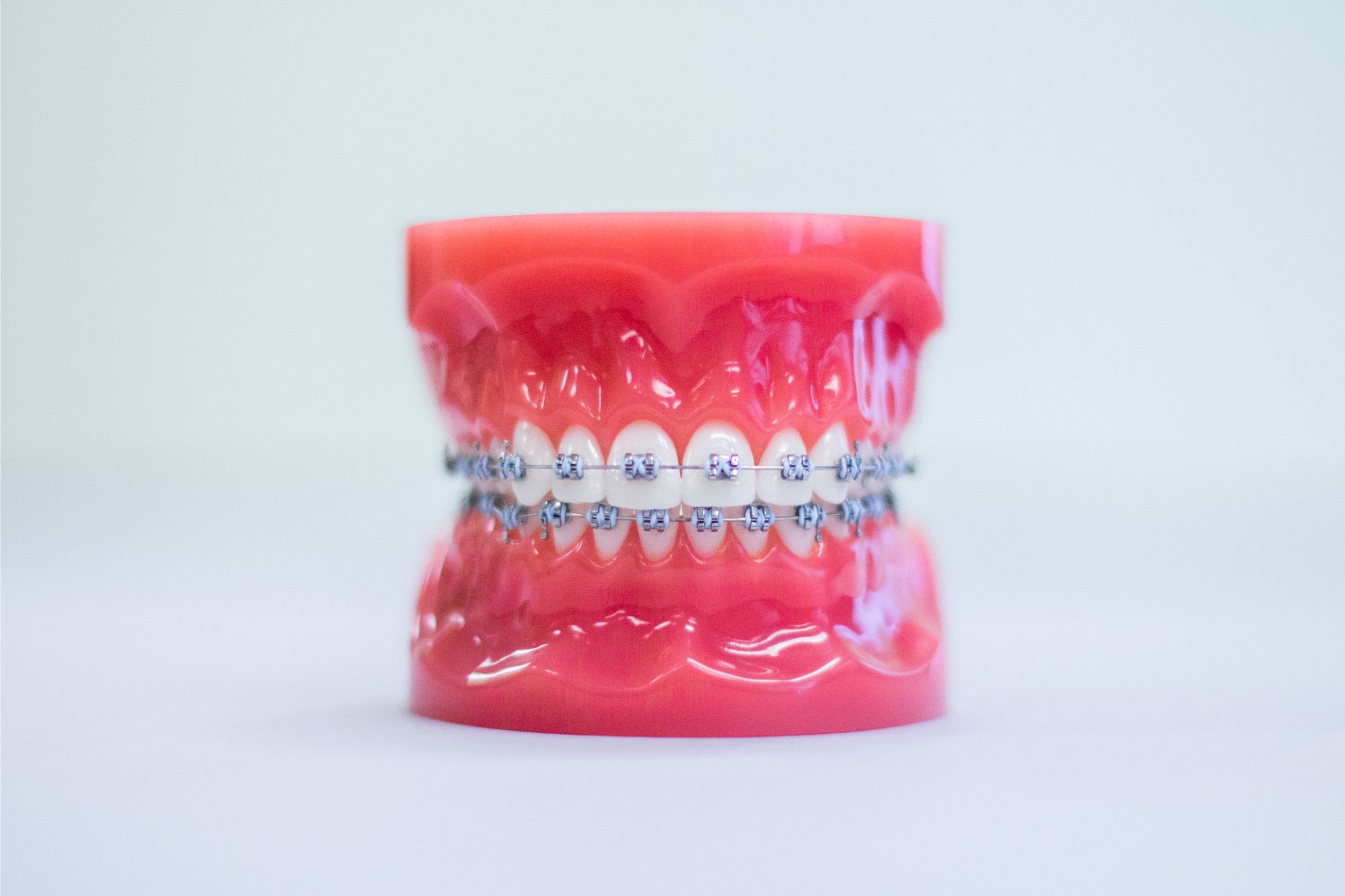 Braces Medina