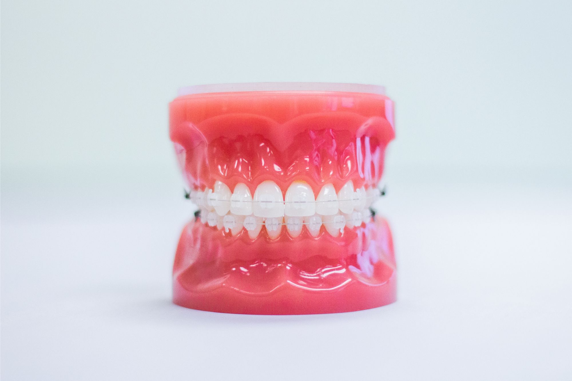 Braces Medina