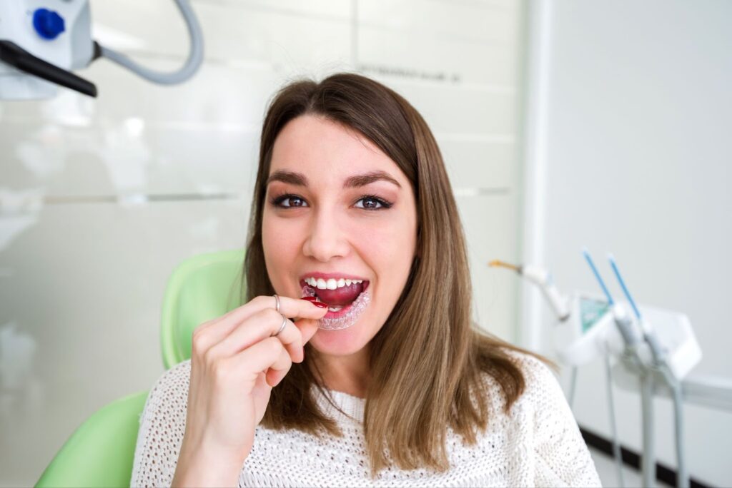 Are Clear Aligners Worth the Investment? 